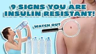 Insulin Resistance Symptoms WHY YOU CANT LOSE WEIGHT [upl. by Rod]