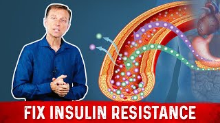 7 Things That Boost Insulin Sensitivity or Reverse Insulin Resistance  Dr Berg [upl. by Darryn]