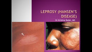 Leprosy [upl. by Akeenat]